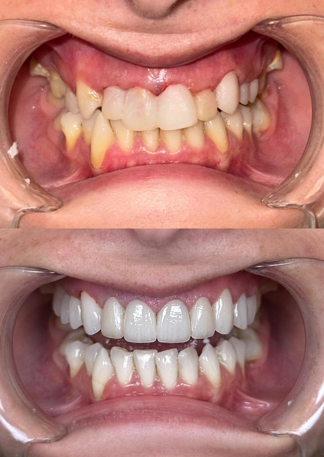 Estetică dentară personalizată • Rezultate naturale • Zâmbete armonioase Estetică dentară personalizată • Rezultate naturale • Zâmbete armonioase