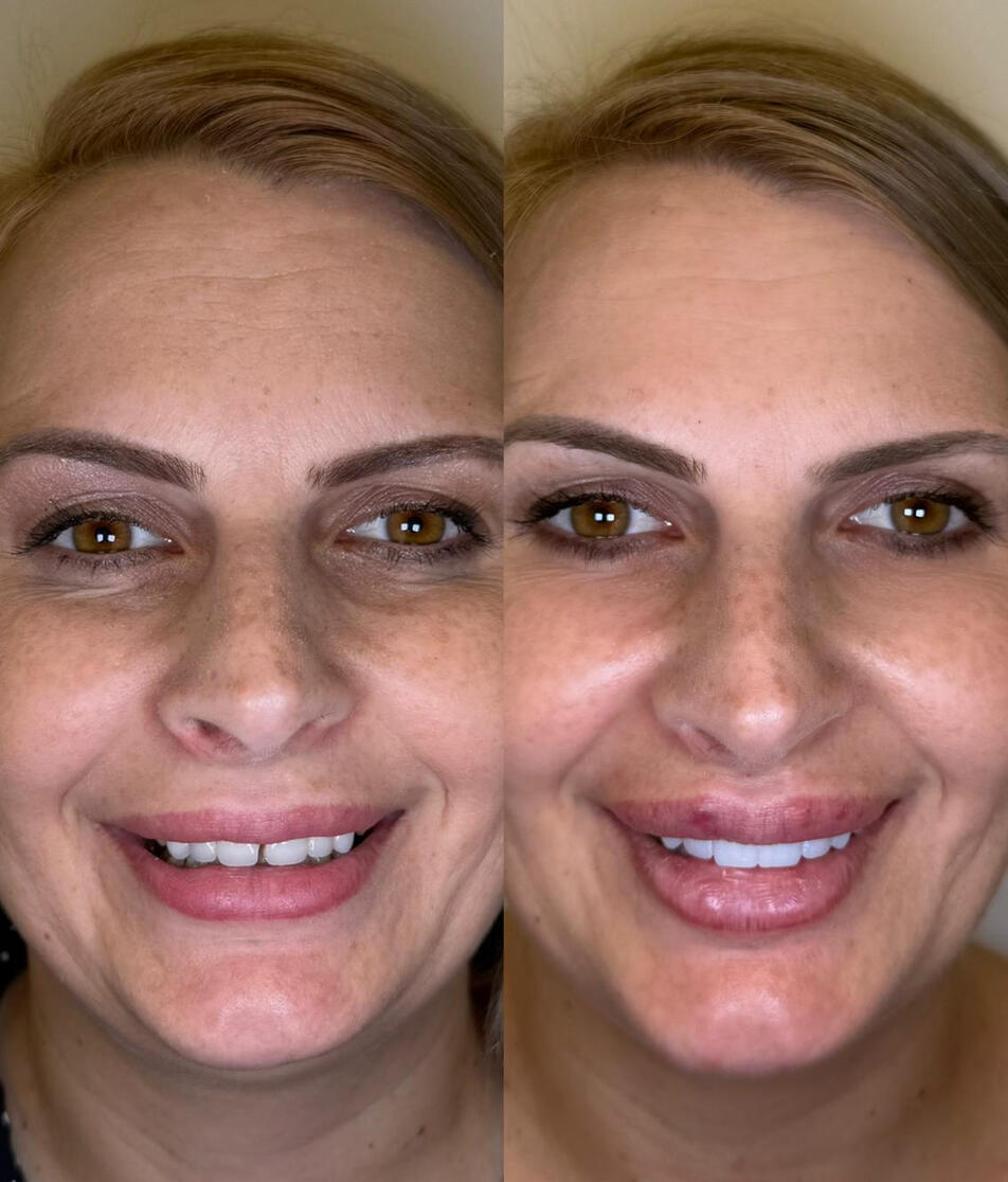 Armonie, estetică și funcționalitate într-un singur zâmbet. Armonie, estetică și funcționalitate într-un singur zâmbet.
