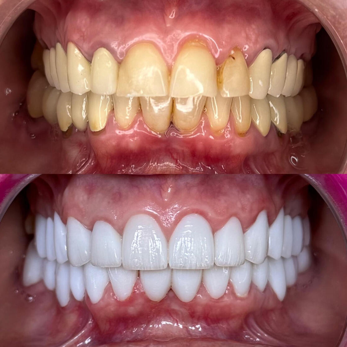 Precizie. Estetică. Rezultate naturale. Precizie. Estetică. Rezultate naturale.